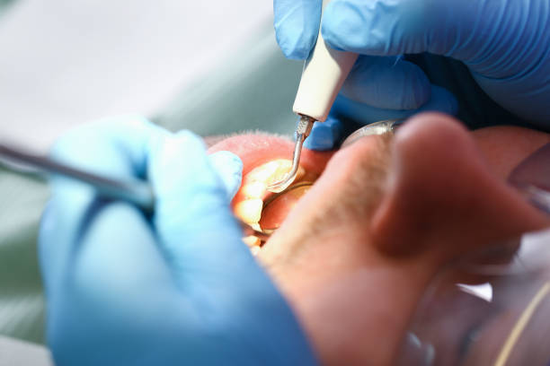 Best Emergency Dentist for Lost Fillings or Crowns in Oakley, KS